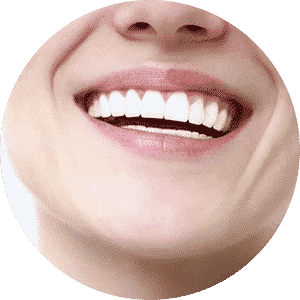 Dental Implants — Dental in Cardiff, NSW