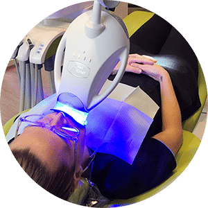 Teeth Whitening — Dental in Cardiff, NSW