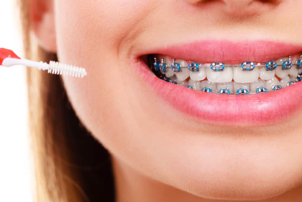 Woman Cleaning Braces — Dental in Cardiff, NSW