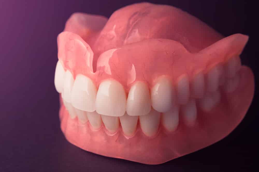 A close-up Of Acrylic Denture made for a patient in Newcastle