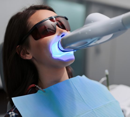 Teeth Whitening Procedure — Dental in Cardiff, NSW